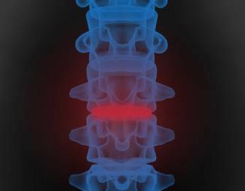 OSTEOPOROZDA RİSK FAKTÖRLERİ